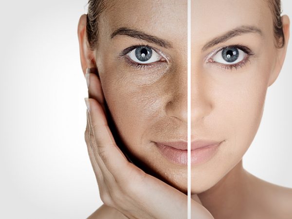 Skin-Rejuvenation-600x450-1